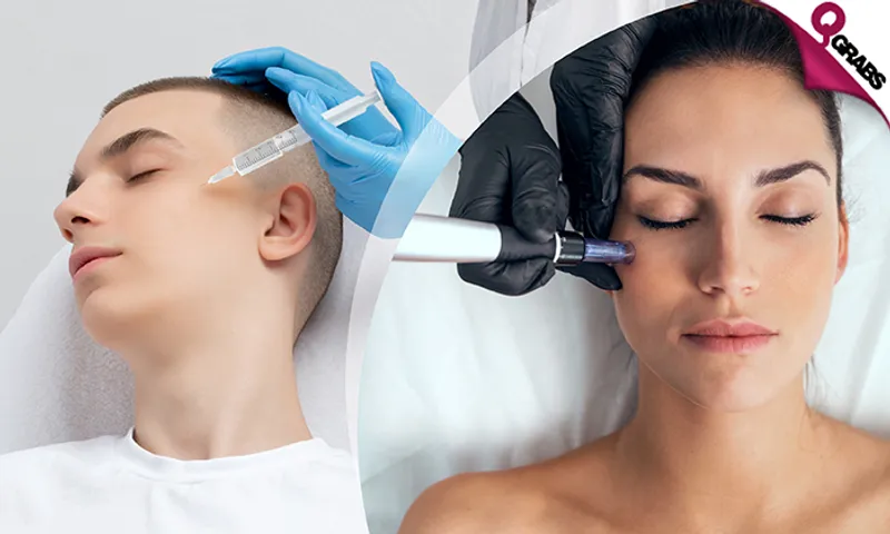 Dermapen & PRP Sessions for Ladies & Men!